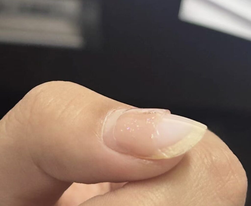Photos of a manicure falling off when a top coat is used as a base coat